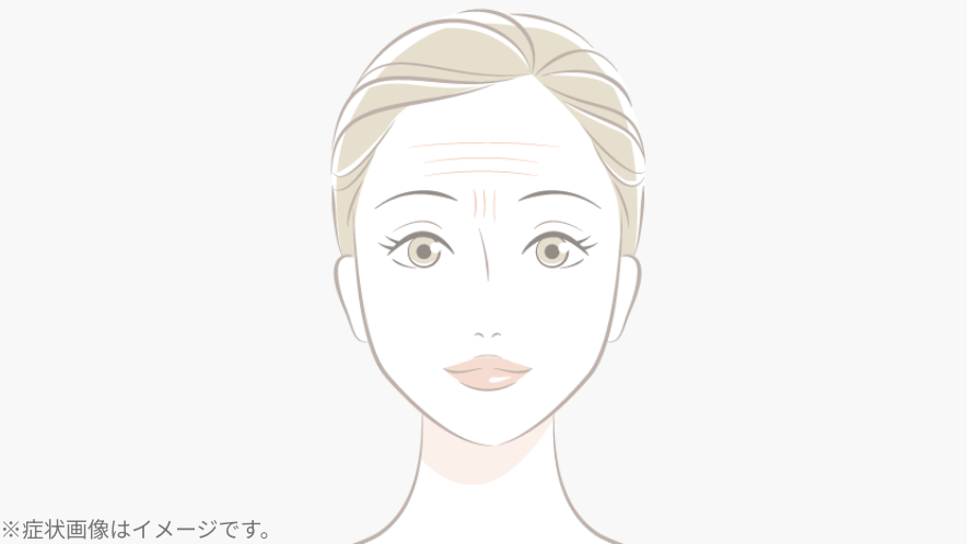 おでこ‧眉間