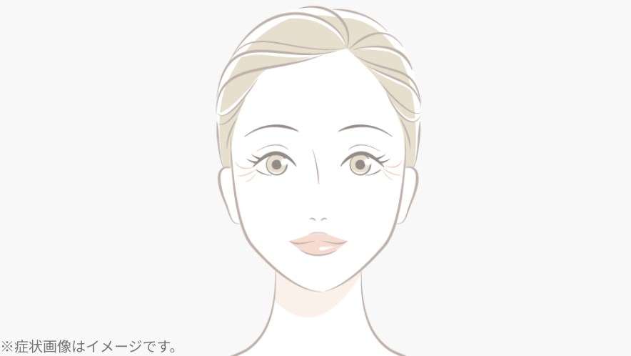 目元