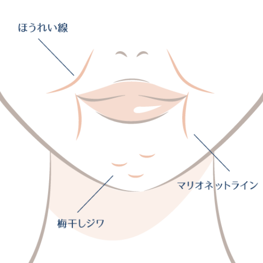 ⼝元の主なしわの種類