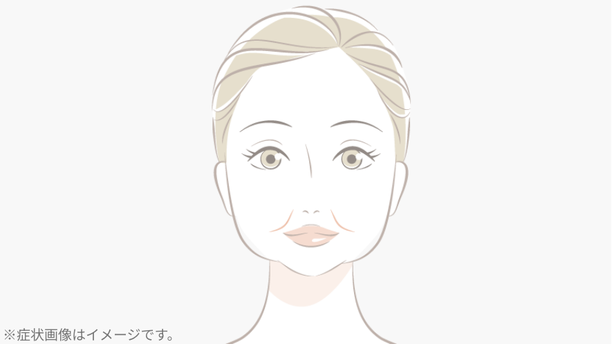 頬