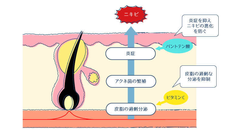 ビタミンCとパントテン酸が皮脂と炎症に作用し、ニキビを改善する図
