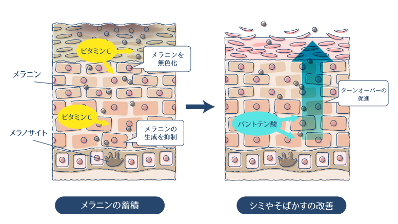 ビタミンCとパントテン酸が、メラニンとターンオーバーに作用しシミ・そばかすを改善する図