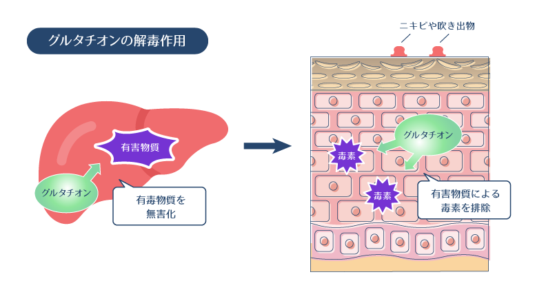 グルタチオンが体内の有害物質を解毒し、肌トラブルを防ぐメカニズムを説明した図。