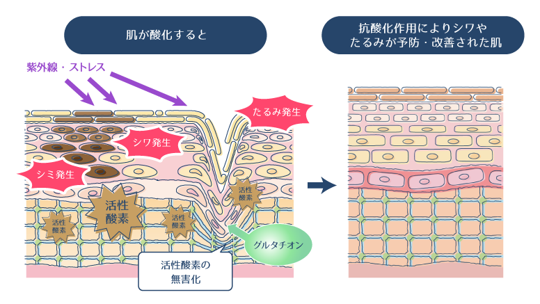 グルタチオンが、活性酸素やフリーラジカルを無害化し、シワやたるみを防ぐメカニズムを説明した図。