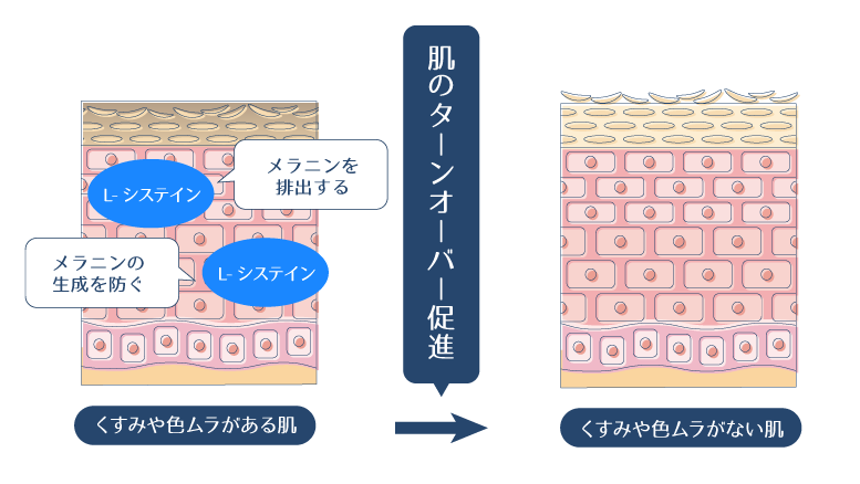 L-システインがターンオーバーを促進することで、メラニンが排出され、くすみが改善することを示した図。
