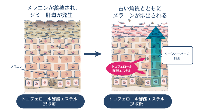トコフェロール酢酸エステルがターンオーバーを促進することで、メラニンが排出され、シミが改善されることを示した図。