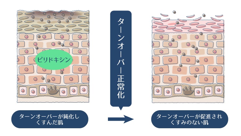 ピリドキシン塩酸塩がターンオーバーを正常化することで、くすみが改善されることを示した図。