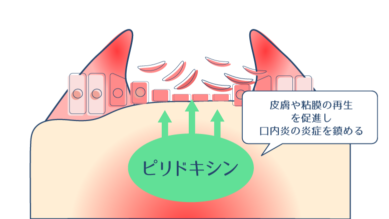 ピリドキシン塩酸塩が皮膚や粘膜の再生を促進し口内炎の炎症を鎮める様子を示した図。