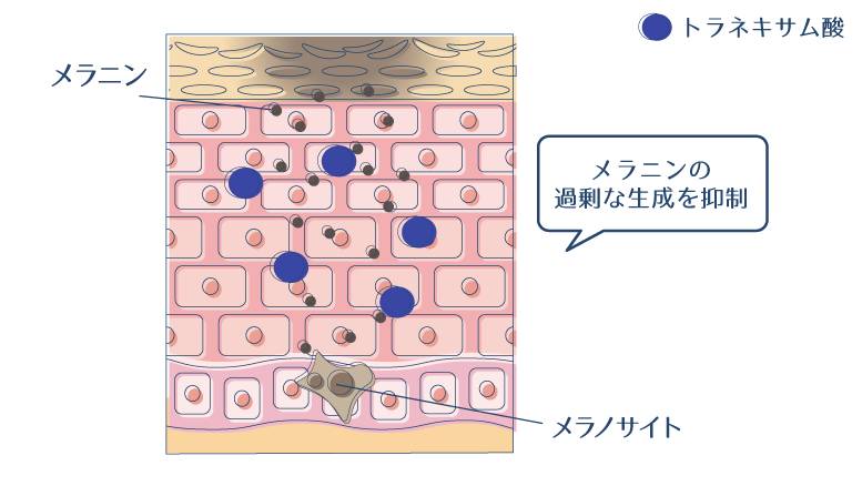 トラネキサム酸がメラニンの過剰な生成を抑制することで、シミや肝斑・くすみが改善されることを示した図。