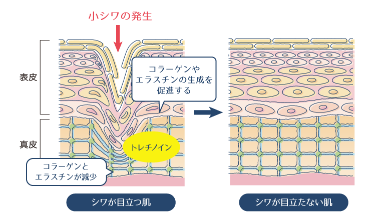 トレチノインの外用により、コラーゲンやエラスチンの分泌が促進され、小じわやたるみが改善されることを示した図。