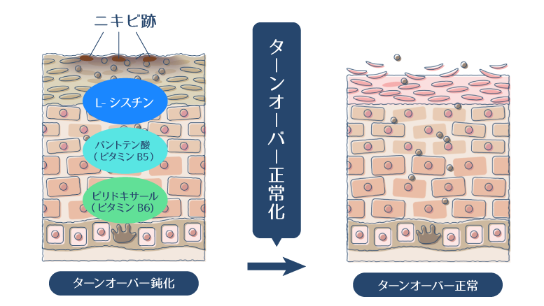 L-シスチン、パントテン酸Ca、ピリドキシン塩酸塩の3つの成分が、肌のターンオーバー正常化作用を発揮する様子を示す図。