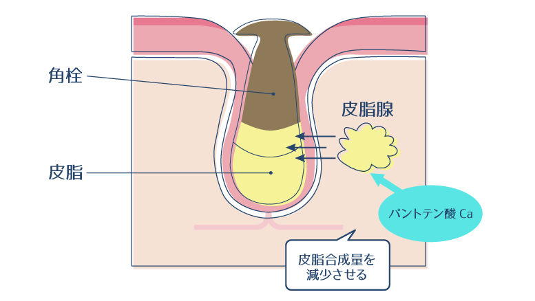 パントテン酸Caが、皮脂腺に皮脂合成量を減少させるように働きかけ、ニキビを改善することを示した図。