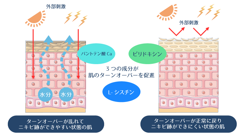 L-シスチン・パントテン酸Ca・ピリドキシンの3つの成分が、肌のターンオーバーを促進し、ニキビ跡ができにくい肌を作れることを示した図。