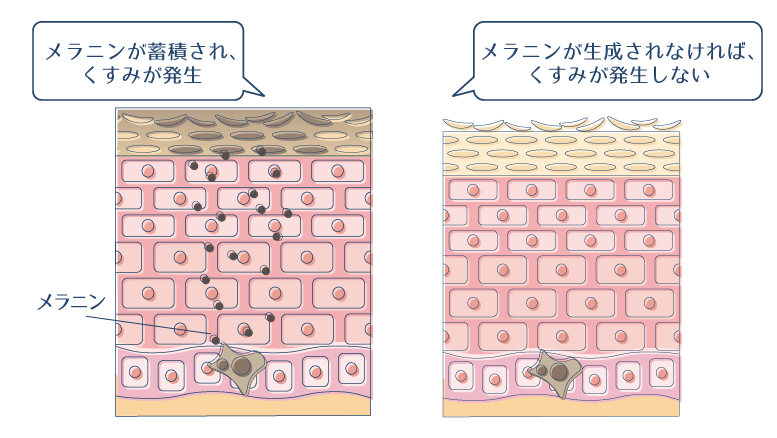 メラニンが蓄積されることで、肌にくすみが発生する一方で、そもそもメラニンが生成されなければくすみが発生しないことを示した図。