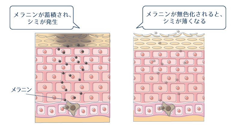 メラニンの蓄積によりシミが発生するので、メラニンを無色化することで、シミが薄くなることを示した図。