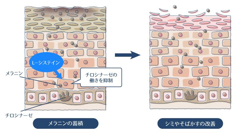 L-システインがチロシナーゼの働きを抑制し、シミ・そばかすを改善する図