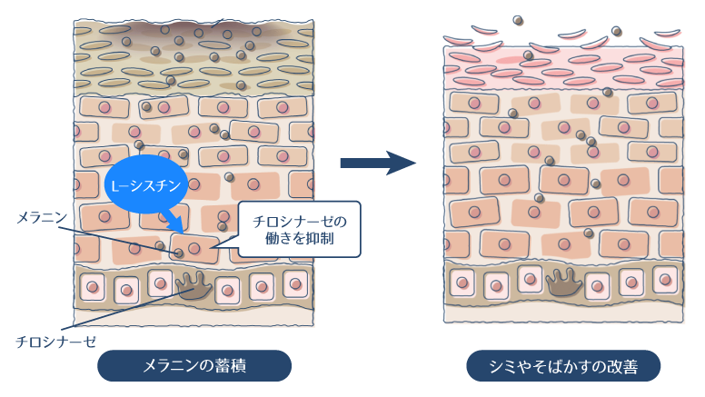 L-シスチンがチロシナーゼの働きを抑制し、シミ・そばかすを改善する図