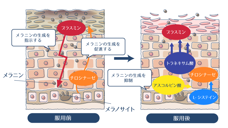 トラネキサム酸・L-システイン・アスコルビン酸の3つの成分がメラニンの生成を抑制することで、シミを予防・改善することを示した図。