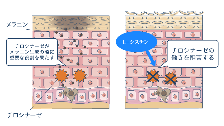 L−シスチンがチロシナーゼの働きを阻害することでメラニンの生成を抑えることを示した図。