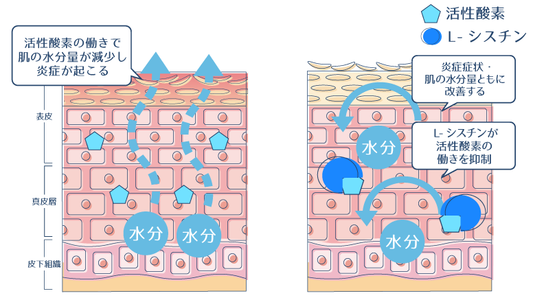肌の水分量を減少させ、炎症の原因となる活性酸素をL-シスチンが抑制することで、炎症症状や肌の乾燥を改善されることを示した図。