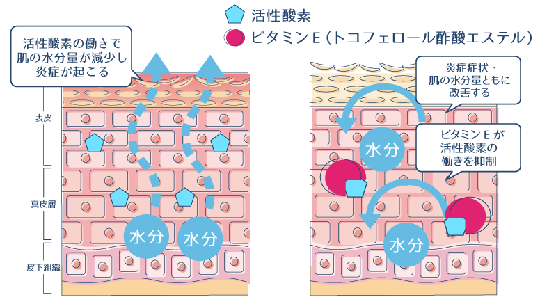 肌の水分量を減少させ、炎症の原因となる活性酸素を、ビタミンEが抑制することで、炎症症状や肌の乾燥が改善されることを示した図。