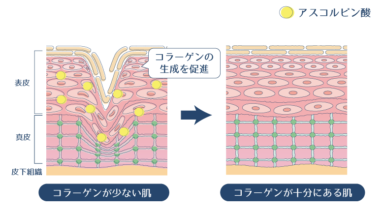 アスコルビン酸がコラーゲンの生成を促進し、弾力を与えることで、シワやたるみを改善する図