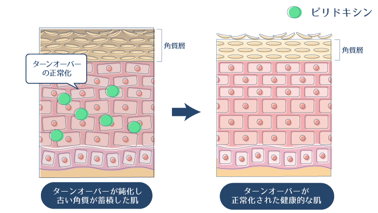 ピリドキシンがターンオーバーを正常化させることで、健康的な肌を維持する図