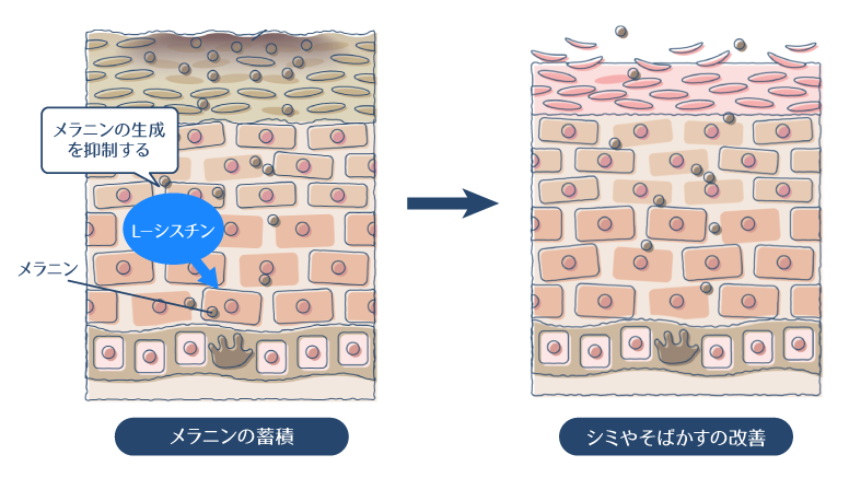 Lシスチンがメラニンの生成を抑制することで、シミ・そばかすが改善される図