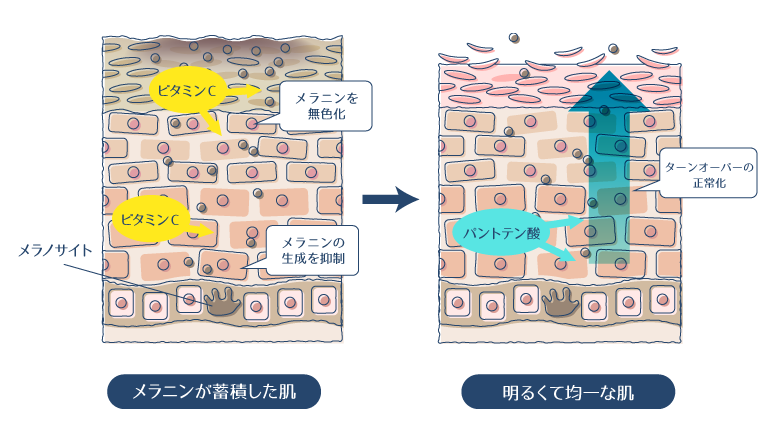 アスコルビン酸がメラニンの無色化・生成を抑制し、パントテン酸がターンオーバーを正常化することでくすみを改善する図