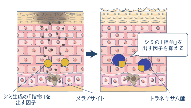 シミ生成の「指令」を出す因子を、トラネキサム酸が抑制し、シミを予防・改善できることを示した図。