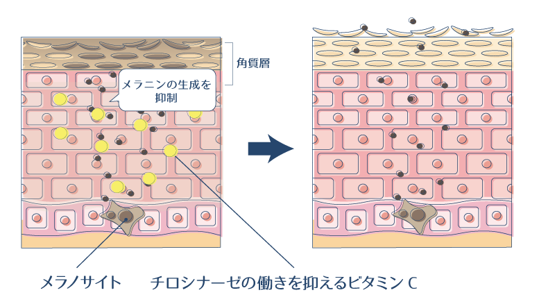 ビタミンCが、メラニン生成に関わる酵素「チロシナーゼ」の働きを抑制することで、シミを予防・改善できることを示した図。
