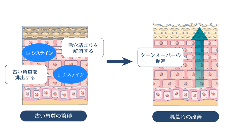 L-シスチンがアミノ酸の一種であることから、肌のターンオーバーを促進させる働きを持つことを示す図
