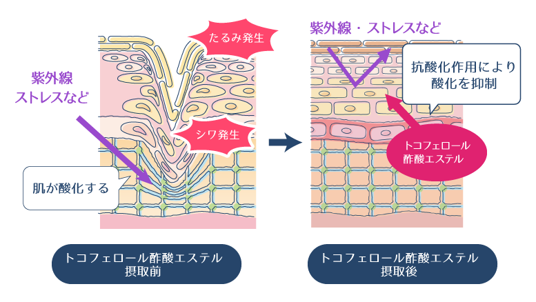 トコフェロール酢酸エステルが抗酸化作用を働かせることで、肌の酸化ダメージを防ぎ、シワやたるみを防ぐ様子を示す図。