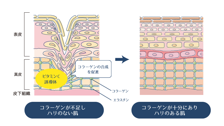ビタミンC誘導体が肌の深部からコラーゲン生成を助けるように働くことで、肌のハリを回復する様子を示す図