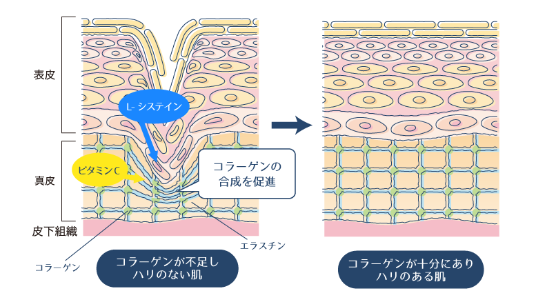 ビタミンCとL-システインがコラーゲンの合成を促進することで、肌にハリが生まれ、シワが改善されることを示した図。