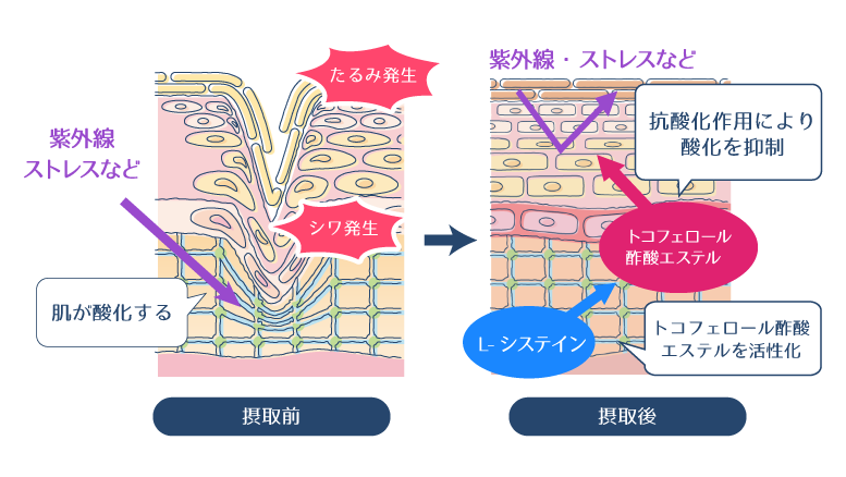 L-システインにより活性化されたトコフェロール酢酸エステルが抗酸化作用を発揮し、肌の酸化を抑制する様子を示した図。