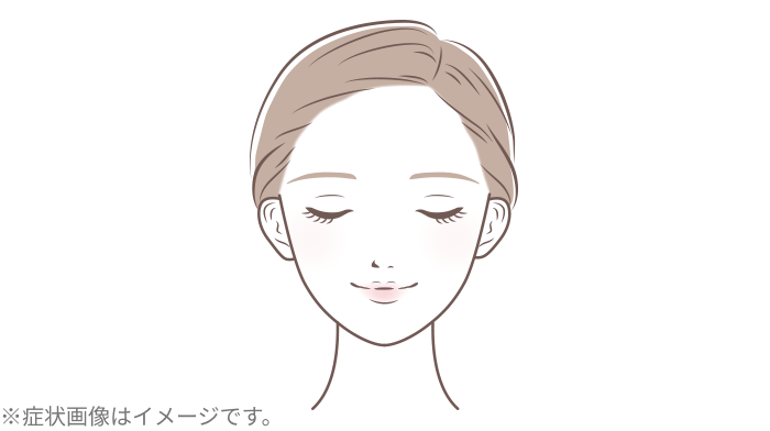 普通肌のストレス由来の肌荒れ