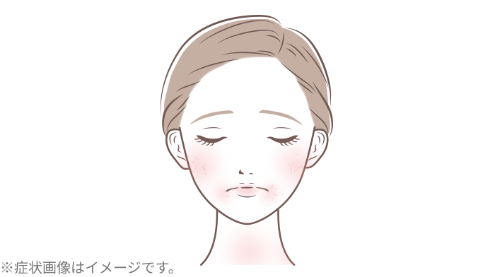 乾燥肌のカサつき・くすみ