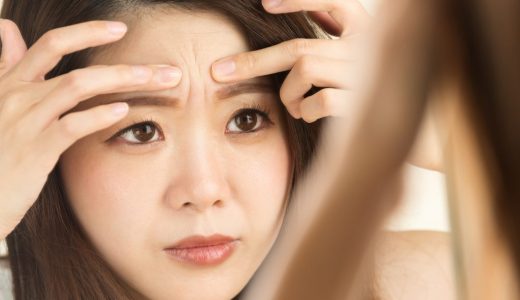 眉間のニキビの原因と治し方とは？もしかして体の不調のサインかも！