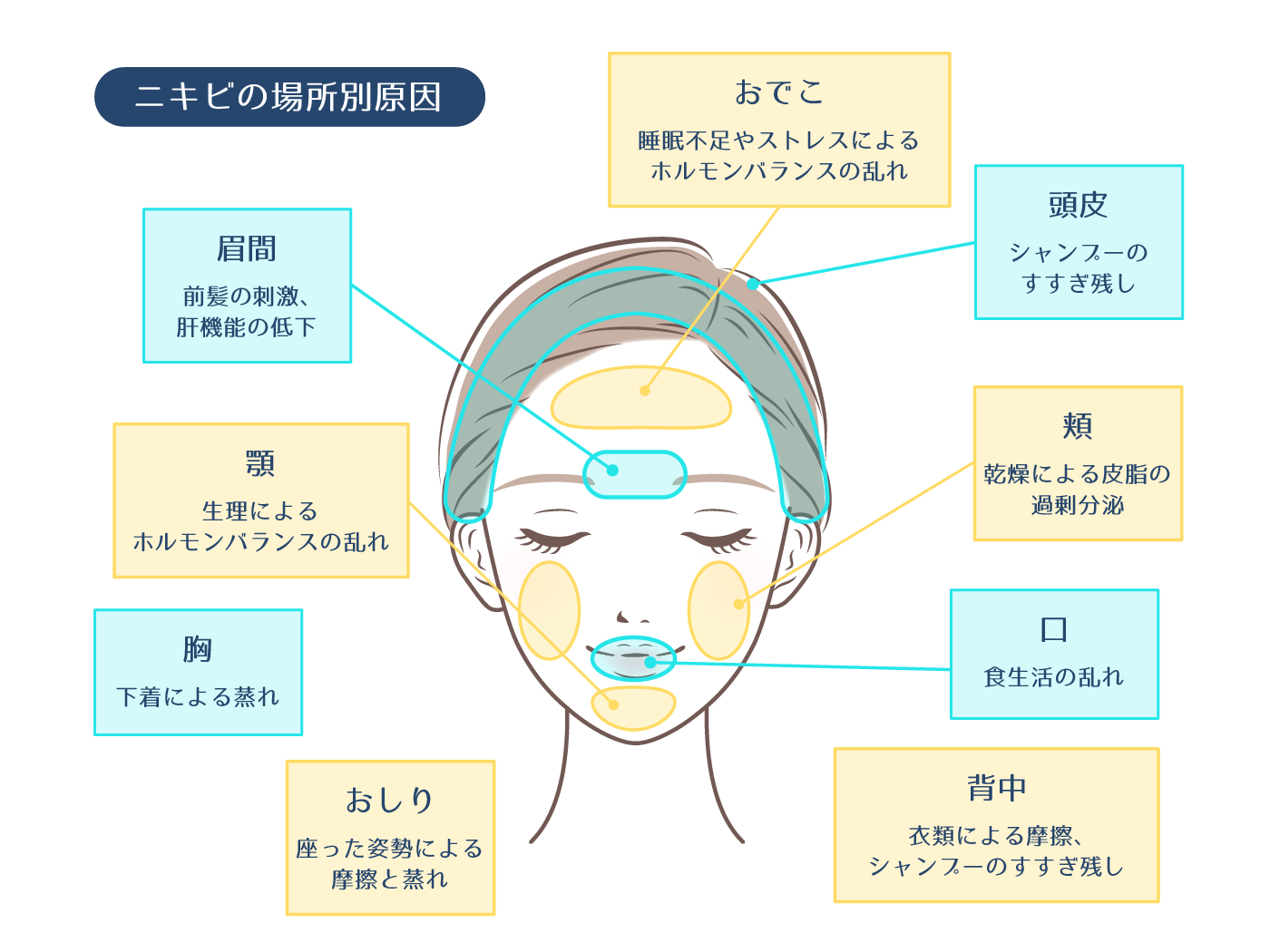 【完全版】即効でニキビを治す方法まとめ！効果的なケア方法とは | ハダメディア by BIHADADO.TOKYO