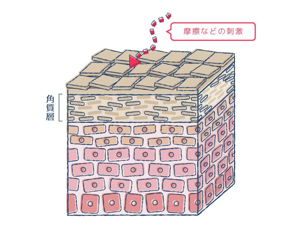 摩擦などの刺激によって肌に傷がついて炎症が起こる仕組み