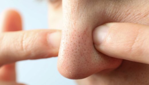 「鼻の毛穴」を簡単になくす方法を解説！黒ずみ・毛穴詰まりができる原因へアプローチ