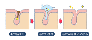 【皮膚科医監修】洗顔後の毛穴の白いポツポツの取り方を解説! | ハダメディア by BIHADADO.TOKYO