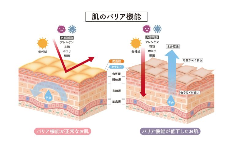バリア機能が正常な肌と低下した肌の構造を比較している画像