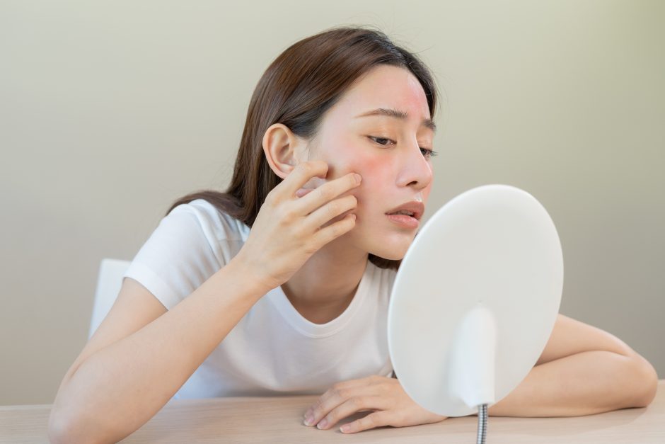 顔ダニがいない人はいない?治し方やニキビとの見分け方を解説 | ハダメディア by BIHADADO.TOKYO