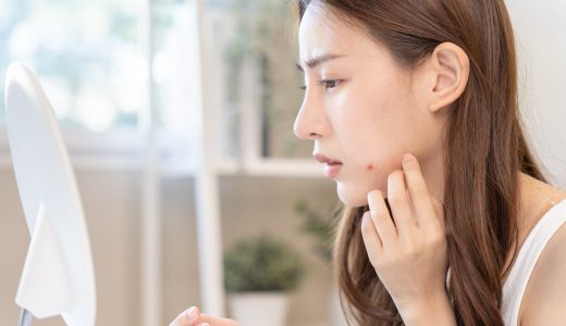 梅毒とニキビの見分け方は？症状や原因の違いから見分ける方法を解説