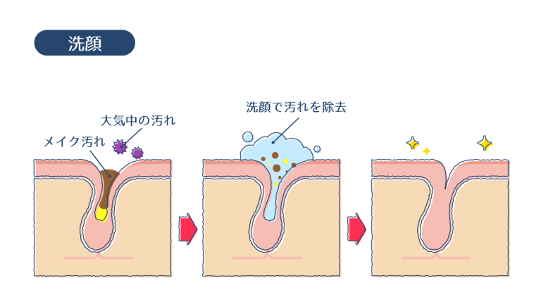 ニキビのパンパンな膿を潰すのはNG！対処法と効果的な薬を解説 | ハダメディア by BIHADADO.TOKYO