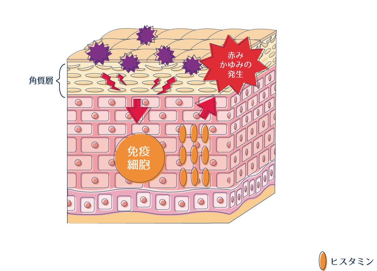 ヒスタミンによって赤みやかゆみなどのアレルギー症状が引き起こされる過程