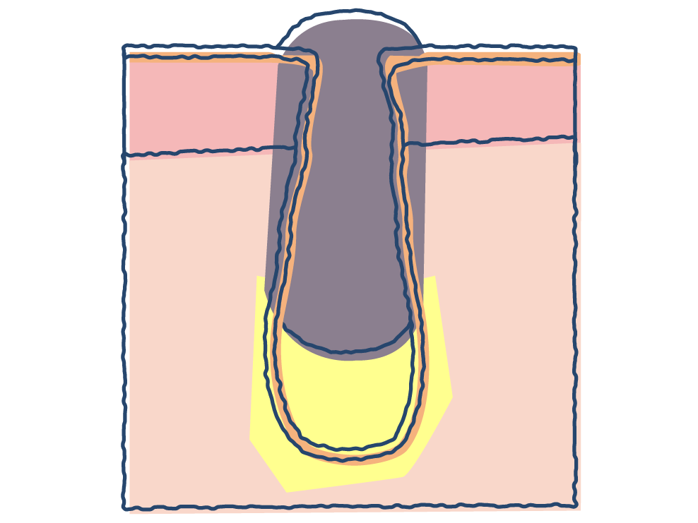 つまり毛穴のメカニズム