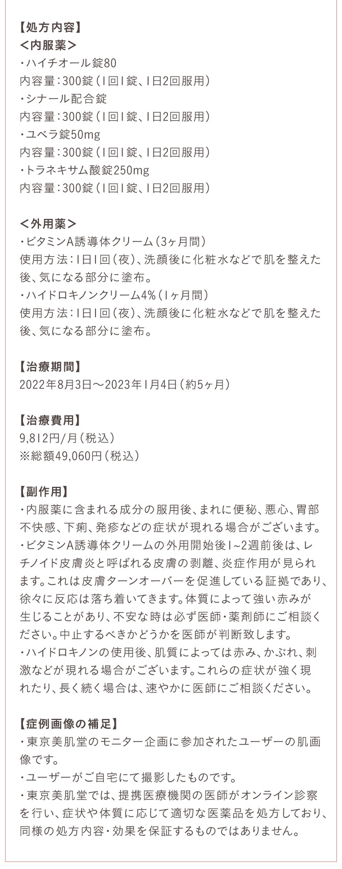 とことん美白対策セット/トレチノインクリーム0.05%/ハイドロキノン4%クリーム